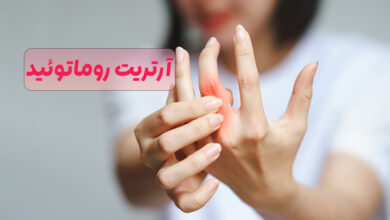 آرتریت روماتوئید
