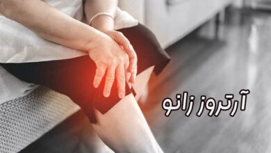 آرتروز زانو