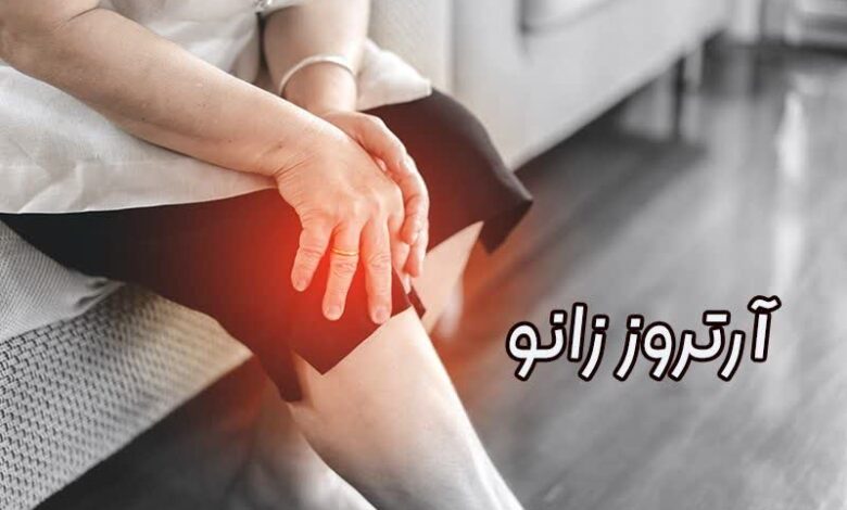 آرتروز زانو