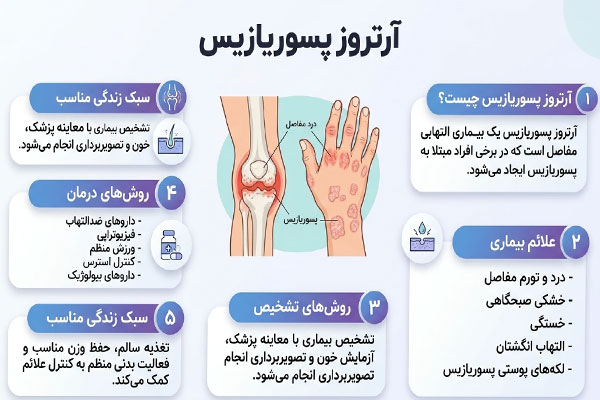 آرتروز پسوریازیس