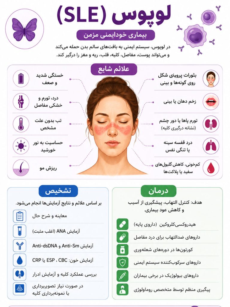 بیماری-لوپوس-علائم-و-تشخیص بیماری لوپوس