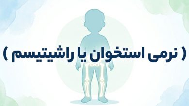 راشیتیسم
