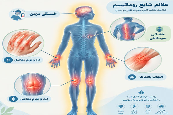 علائم-روماتیسم علائم روماتیسم