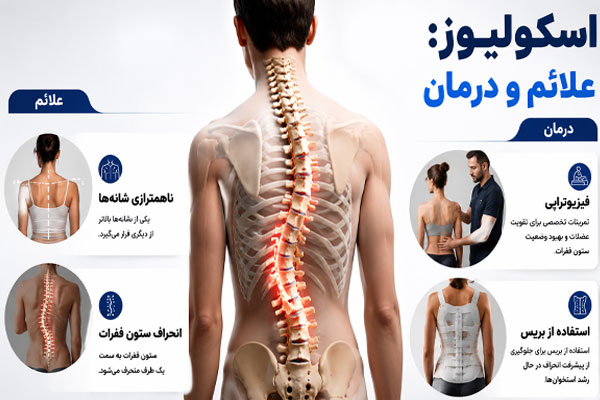 46666 اسکولیوز