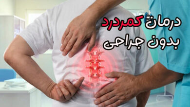 درمان کمردرد بدون جراحی