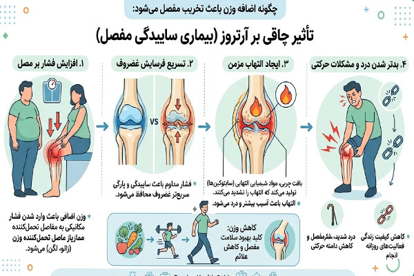  تاثیر چاقی بر روند پیشرفت آرتروز