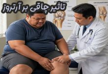 تاثیر چاقی بر آرتروز