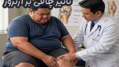 تاثیر چاقی بر آرتروز