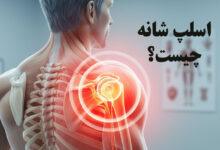 اسلپ شانه چیست؟