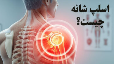 اسلپ شانه چیست؟