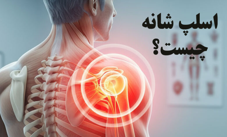 اسلپ شانه چیست؟