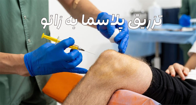 تزریق پلاسما به زانو 
