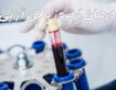 تزریق پلاسما به زانو و پی آر پی (PRP) | درمان تخصصی آرتروز در ارتوسل