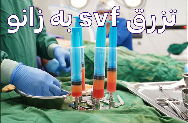 تزریق svf چربی به زانو