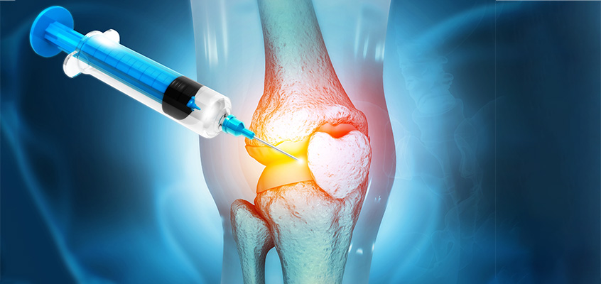 تزریق سلول بنیادی به مفاصل