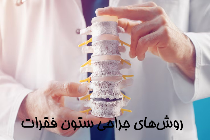 روش‌های جراحی ستون فقرات