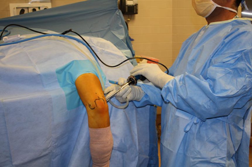 عمل جراحی شانه