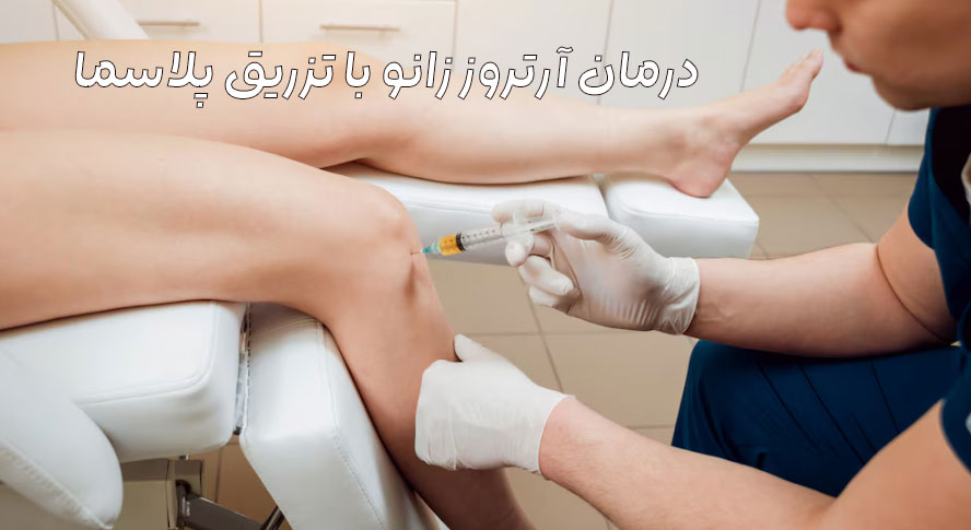 پلاسما درمانی زانو