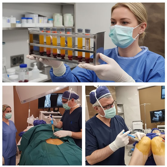 تزریق svf به زانو